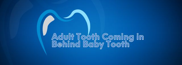 Adult Tooth Coming in Behind Baby Tooth